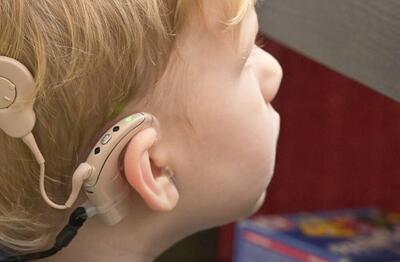 جراحی کاشت حلزون برای ۵ معلول شنوایی در قزوین