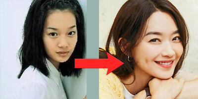 این بازیگر کره‌ای چه جراحی‌هایی انجام داده که صورتش از این رو به آن رو شده؟ تصویر قبل از عمل شین مین آ - چی بپوشم