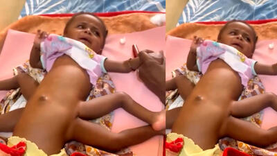فیلم نوزاد عجیب الخلقه با 8 دست و پا ! / پزشکان جهان شوکه شدند !
