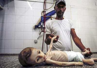 جنگ اسرائیل با کودکان؛ تراژدی دردناک مرگ براثر گرسنگی در غزه - تسنیم
