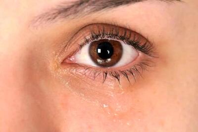 16 راهکار علمی برای جلوگیری از خشکی چشم