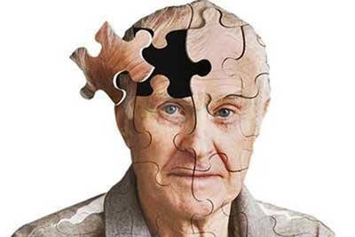 روشی که آلزایمر را ۹ سال زودتر پیش‌بینی می‌کند