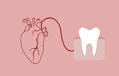 عفونت دندان چه تاثیری بر قلب دارد؟