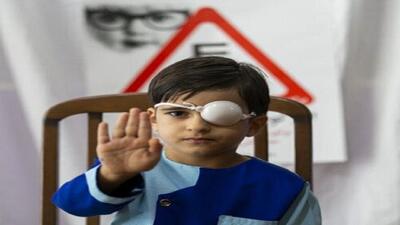 معاینه ۷۳ هزار کودک کردستانی در قالب طرح پیشگیری از تنبلی چشم