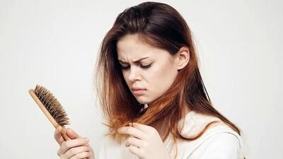 چه عواملی در ریزش موی زنان تاثیر گذار است؟| جزییات بیشتر را اینجا بخوانید