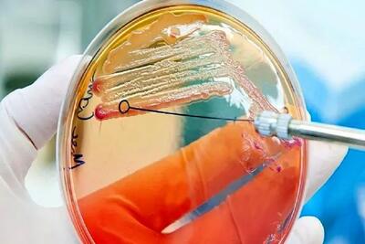 آنتی‌بیوتیک جدیدی که با باکتری‌های خوب کاری ندارد