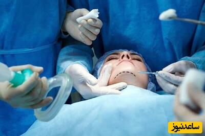 6 هزار اکانت اینستاگرامی جراحی زیبایی و 10 هزار عمل زیبایی توسط دکتر قلابی!