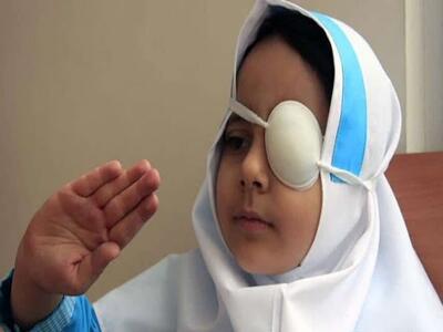 سنجش بیش از ۴ هزار کودک در طرح پیشگیری از تنبلی چشم