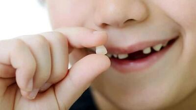 دندان شیری چه تاثیری بر دندان های دائمی دارد؟