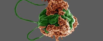 میکروربات‌های جلبکی کوچک می‌توانند درمان سرطان ریه را متحول کنند