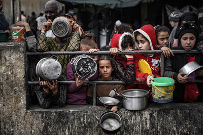 آنروا: بیش از ۵۰ هزار کودک در غزه دچار سوءتغذیه شدید هستند