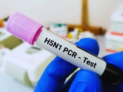 ویروس آنفلوانزای پرندگان H5N1 در شیر خام با عملیات حرارتی کاهش یافت
