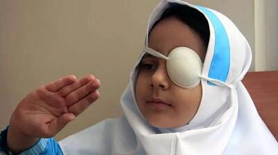 اجرای طرح پیشگیری از تنبلی چشم کودکان در هرمزگان