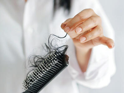 ریزش مو چه زمانی غیرطبیعی است؟/ شایع ترین علل ریزش مو چیست؟ - عصر خبر