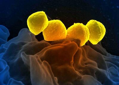 شیوع یک باکتری خطرناک/ این بیماری ۲ روزه منجر به مرگ می‌شود
