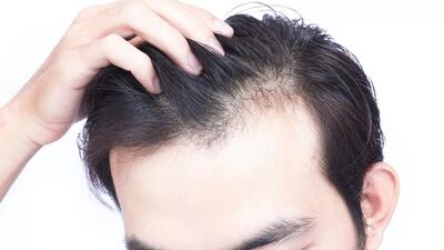 دستاورد محققان: توقف ریزش مو با مسدود کردن یک مکانیسم زیستی کهن