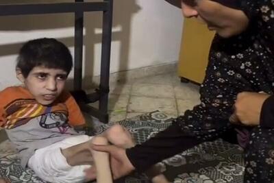 تراژدی غم‌بار جنگ برای کودکان غزه/ پیامدهای مستقیم ناامنی غذایی