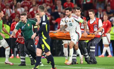 شکستگی استخوان صورت بازیکن مجارستان!