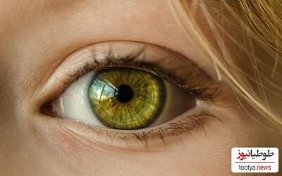 (فیلم) کمیاب ترین رنگ چشم جهان چه رنگی هستند؟! / زیبایی این رنگ چشم ها همه رو به خودشون خیره می کنند😍