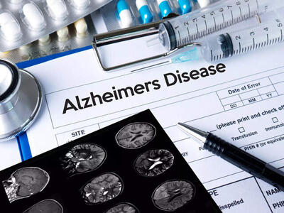 یک عامل مهم برای پیشگیری از آلزایمر را بشناسید - عصر خبر