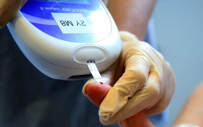 درمان زخم دیابتی با نانوذرات اکسید مس