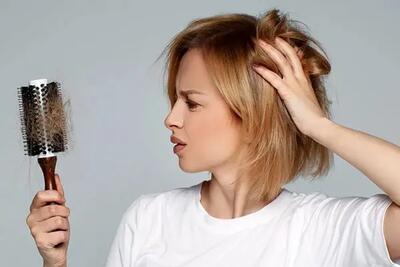 چگونه به صورت طبیعی جلوی ریزش مو را بگیریم / راهنمای کامل برای تقویت و درمان ریزش مو
