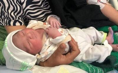 تولد نوزاد عجول در اورژانس