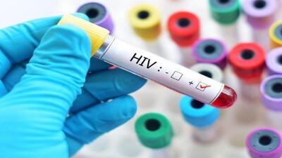 خالکوبی بدون رعایت اصول بهداشت یکی از راه‌های انتقال اچ آی وی است