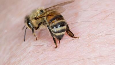 نیش زنبور در چشم انسان باعث کوری می‌شود؟