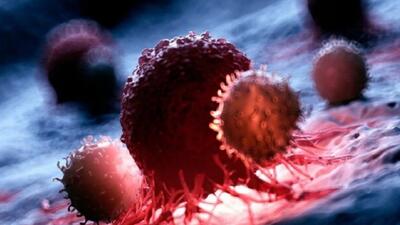 پایان کارآزمایی بالینی روی نانوداروی ضدسرطان حاوی RNA
