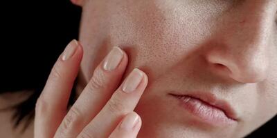 برای درمان خشکی پوست در تابستان این راهکارها نجات‌بخش است