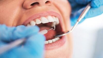 نکاتی مهم برای سلامت دهان و دندان در بیماران کلیوی