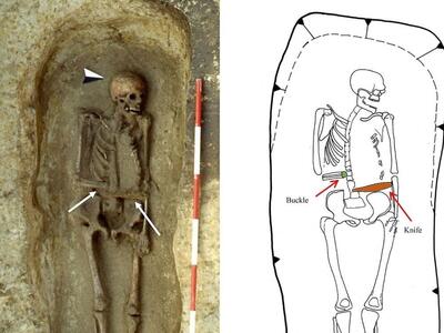 کشف اسکلت و اندام مصنوعی در گورستان قرون وسطایی
