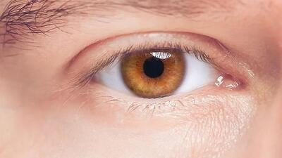 رایج‌ ترین رنگ چشم در سراسر دنیا کدام است؟