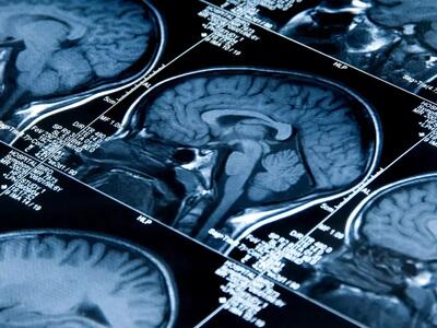 تحقیق جدید: شب‌زنده‌دارها عملکرد مغزی بهتری نسبت به افراد سحرخیر دارند