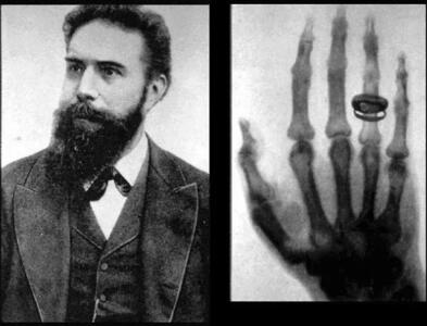 (عکس) اولین تصویر اشعه ایکس جهان؛ دست همسر کاشف آن است