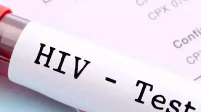 آیا HIV و ایدز یکی هستند؟ |  HIV به طور طبیعی قابل درمان است؟
