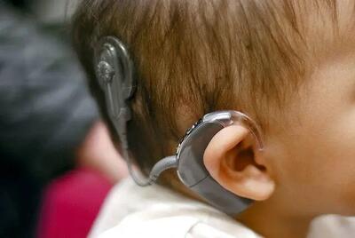 شناسایی ۳۹۶۳ نوزاد دارای اختلالات شنوایی در سال ۱۴۰۲