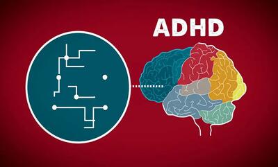 نحوه انجام تست ADHD+فیلم