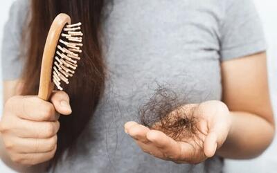 تفاوت ریزش مو در زنان و مردان/ ۳ نکته در ریزش موی مردان