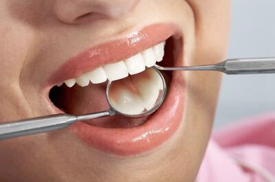 راهکار عالی برای پیشگیری از پوسیدگی دندان‌های دائمی (فیلم)