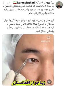 عکس/ تغییر چهره افغانی‌های مقیم ایران به دست جراحان پلاستیک برخلاف قانون | اقتصاد24