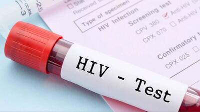 داروی جدید پیشگیری از HIV در آزمایش روی زنان اثربخشی ۱۰۰ درصدی نشان داد