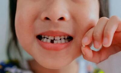 زمان و ترتیب افتادن دندان‌های شیری در کودکان