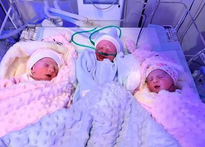 سه قلو های تحت درمان در آباده فارس به دنیا آمدند