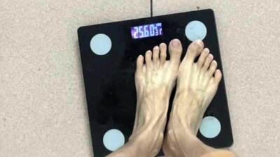 این زن چینی به لاغر شدن اعتیاد دارد؛ ۲۵ کیلو وزن