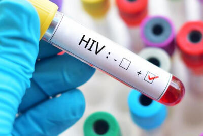 نجات هفتمین بیمار از HIV