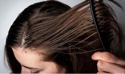 راهکارهای خانگی برای مراقبت از موهای چرب