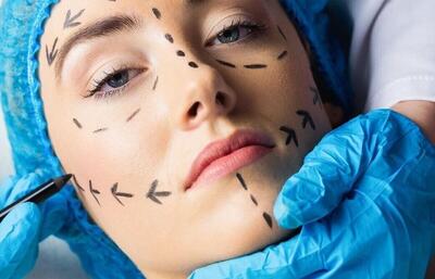 با سونامی عمل‌های زیبایی مواجهیم/ افزایش ۴۰ درصدی آمار جراحی زیبایی در دنیا
