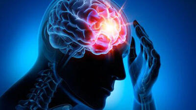روزانه حدود ۵۰۰ نفر دچار سکته مغزی می‌شوند / سردرد شایع‌ترین علت مراجعه به درمانگاه‌ها